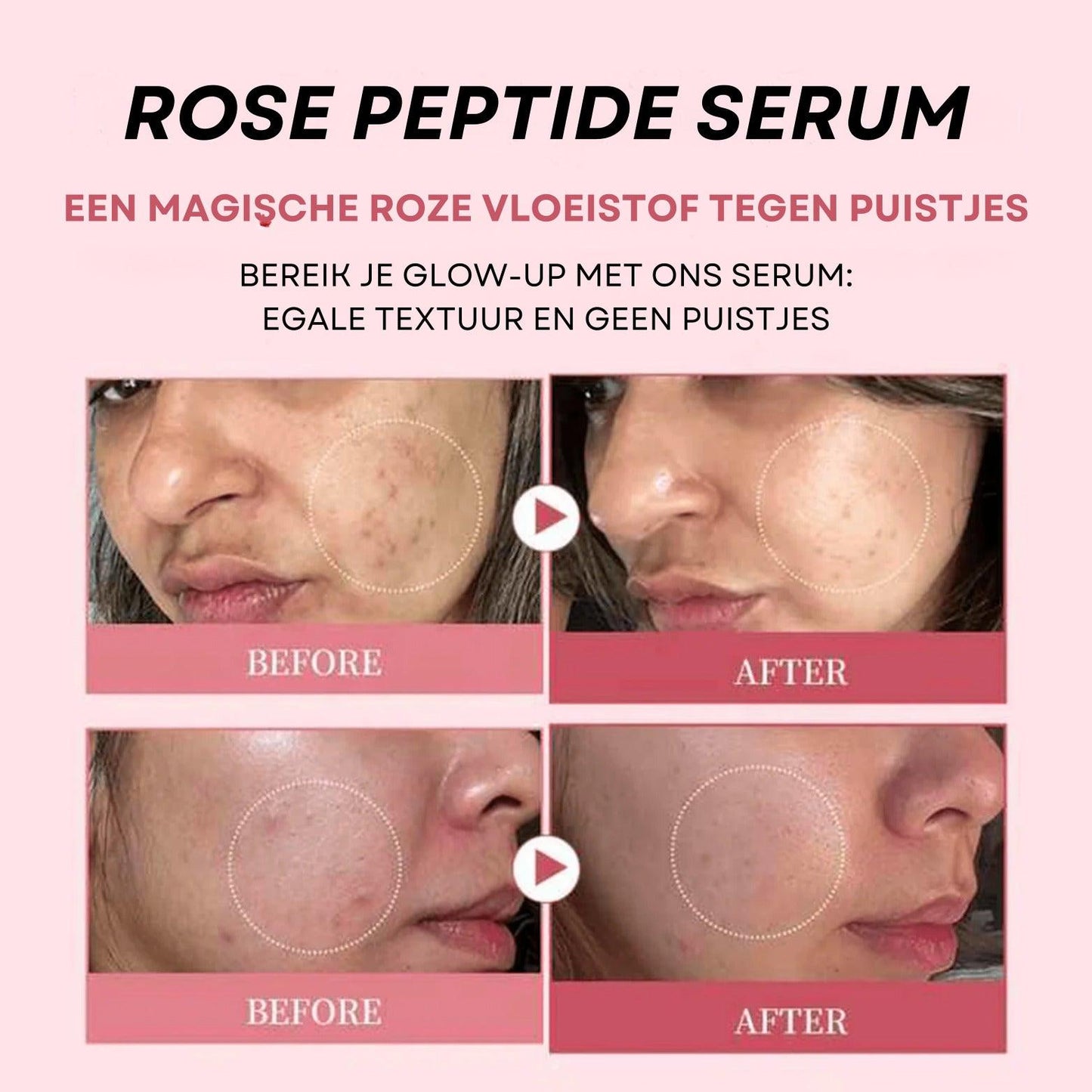 Rose Peptide Serum met PDRN