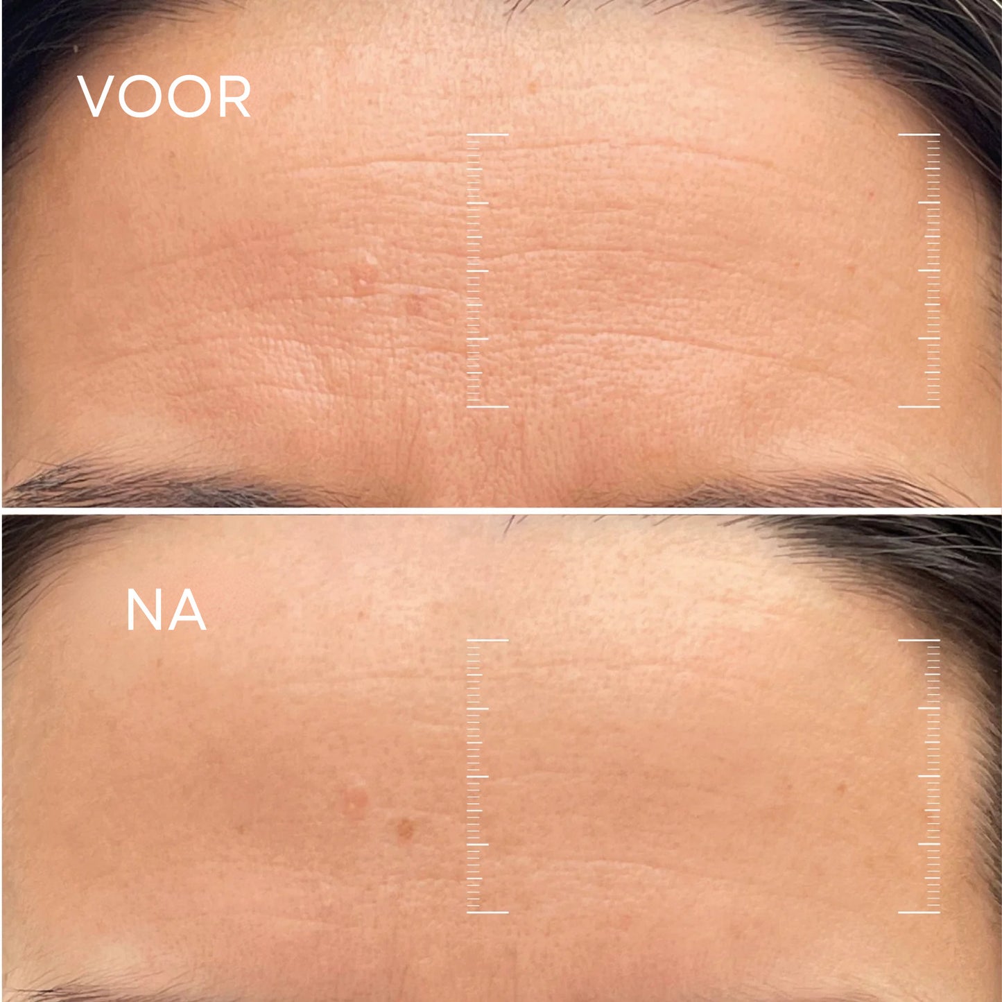 Bio-Collageen Masker + Kwast