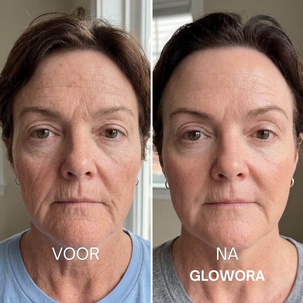 Falten rund um den Mund