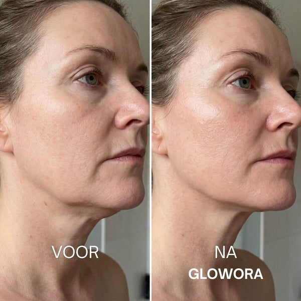 Feine Linien rund um die Lippen