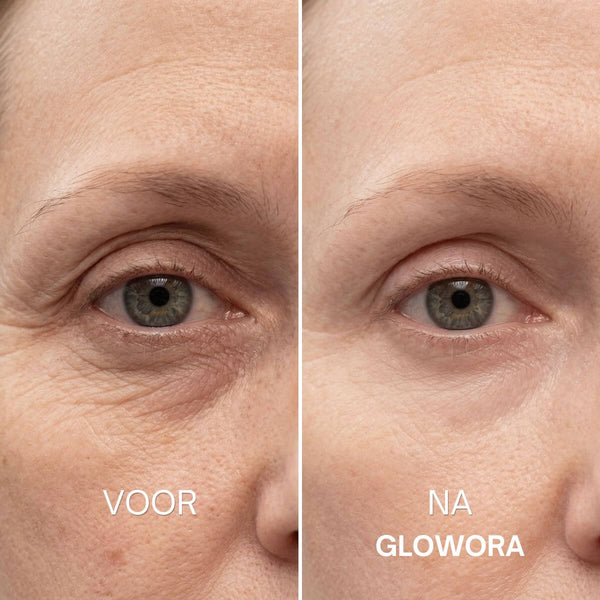 Erschlaffte Kinnlinie