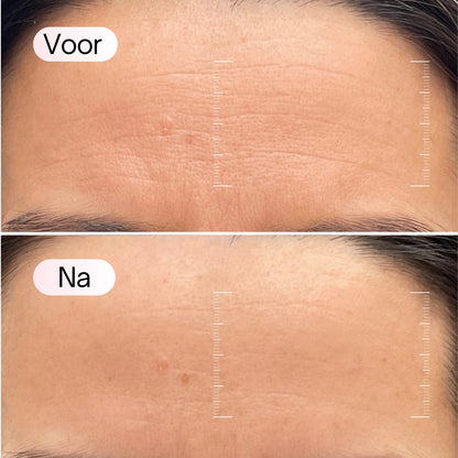 Bio-Kollagen-Maske + Pinsel