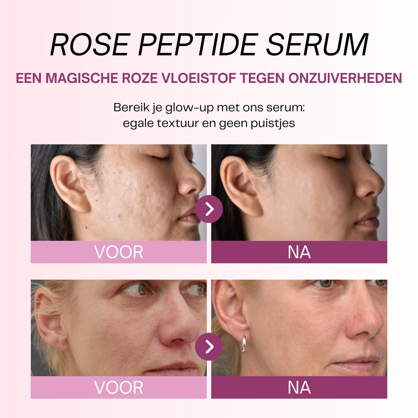 Rosen-Peptid-Serum mit PDRN