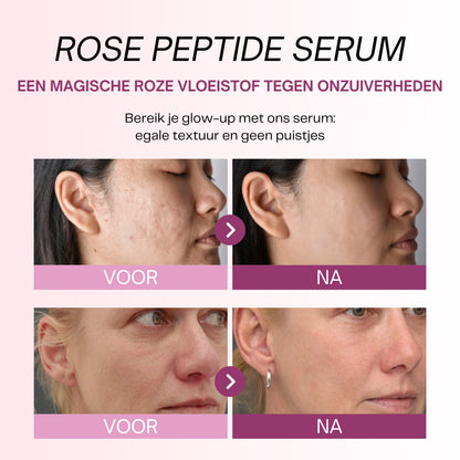 Rosen-Peptid-Serum mit PDRN